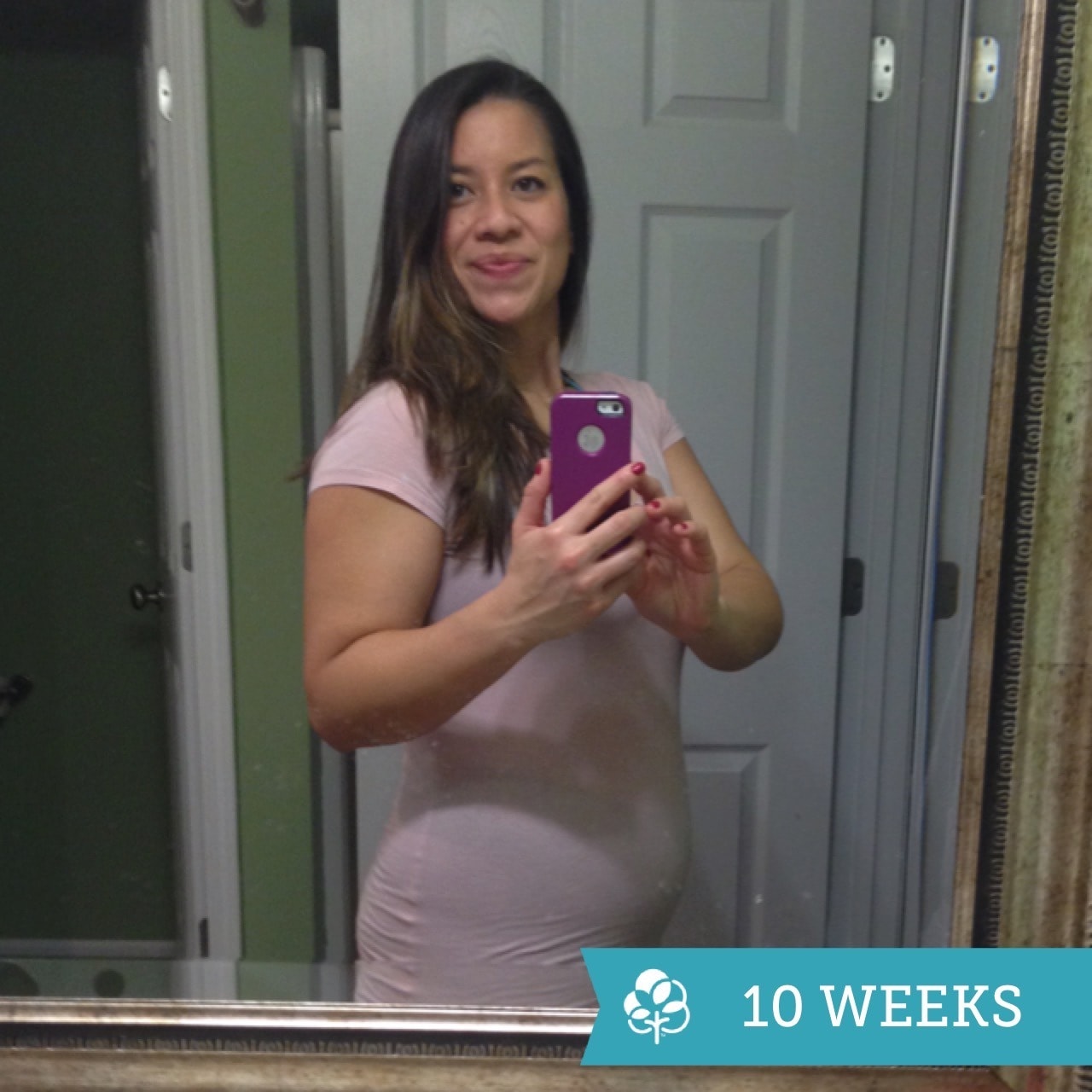 10 week pregnant with twins