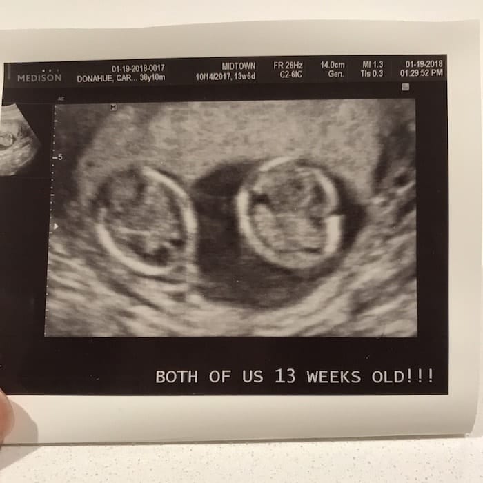 13 weeks pregnant with twins