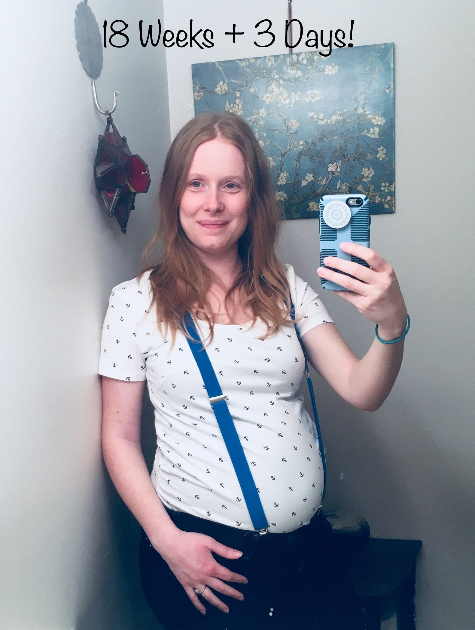 18 weeks pregnant with twins