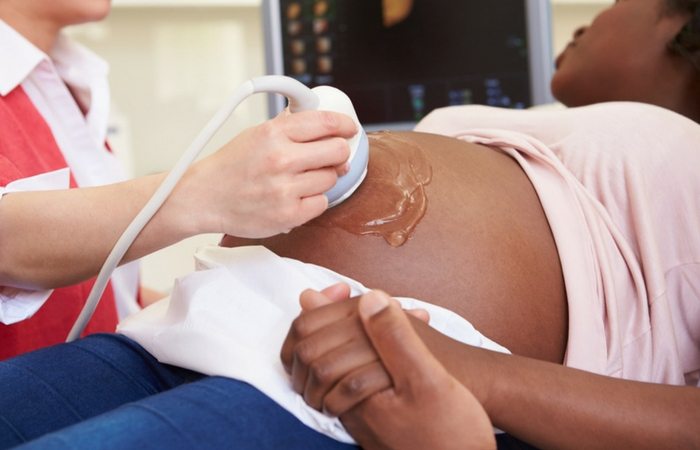 African American woman finding out she is having twins at a later ultrasound.