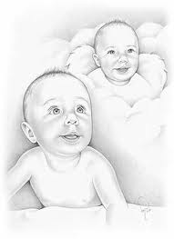 Twin to Twin Transfusion Syndrome