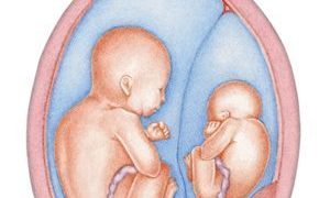 The Ultimate Twin Pregnancy Guide