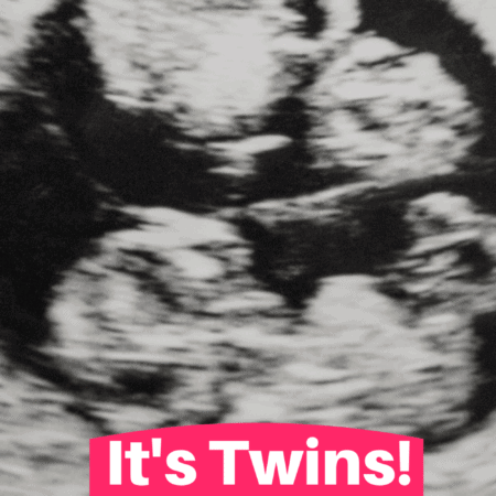 Did You Find Out It Was Twins At A Later Ultrasound?