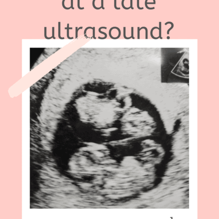 Did You Find Out It Was Twins At Later Ultrasound? Twin Ultrasound?