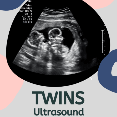 Did You Find Out It Was Twins At A Later Ultrasound?