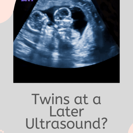 Ultrasound when do up on twins show Question: When