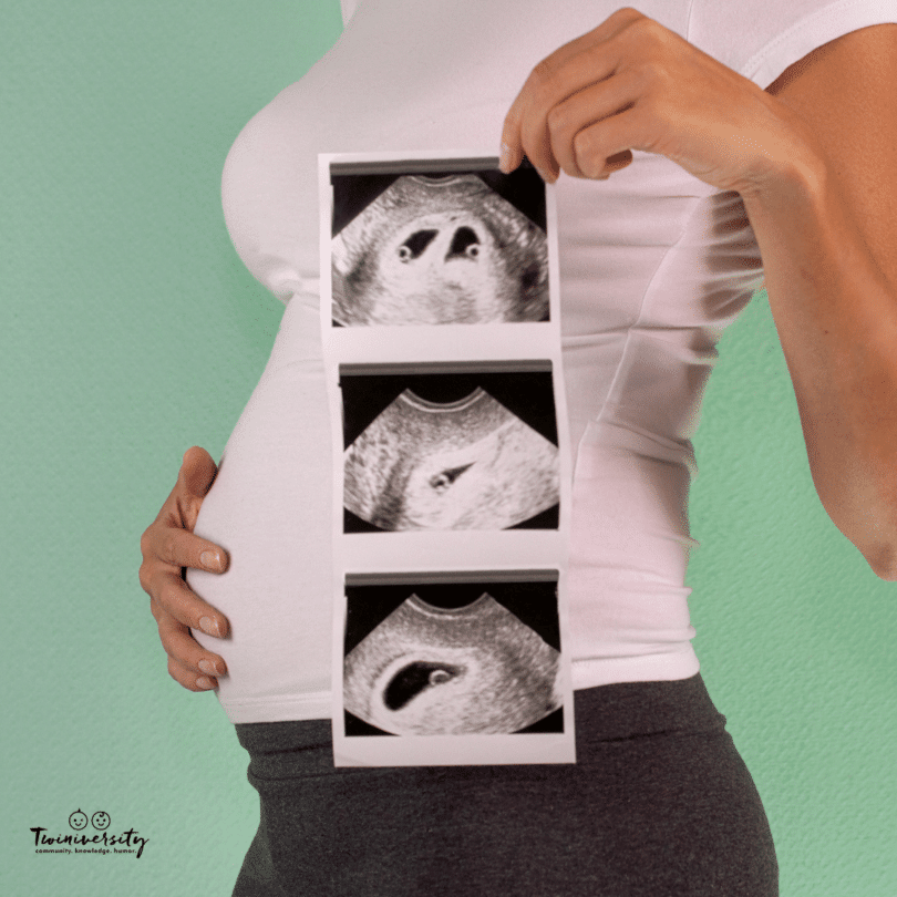 pregnant woman holding sonogram pictures