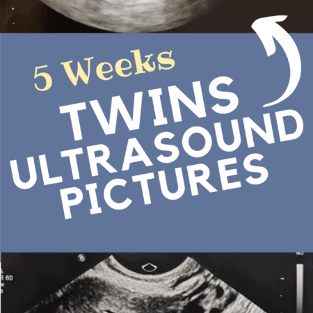 5 weeks twins ultrasound