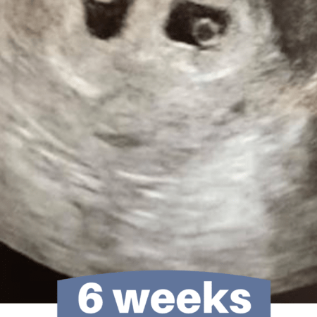 6 veckors ultraljudsbilder
