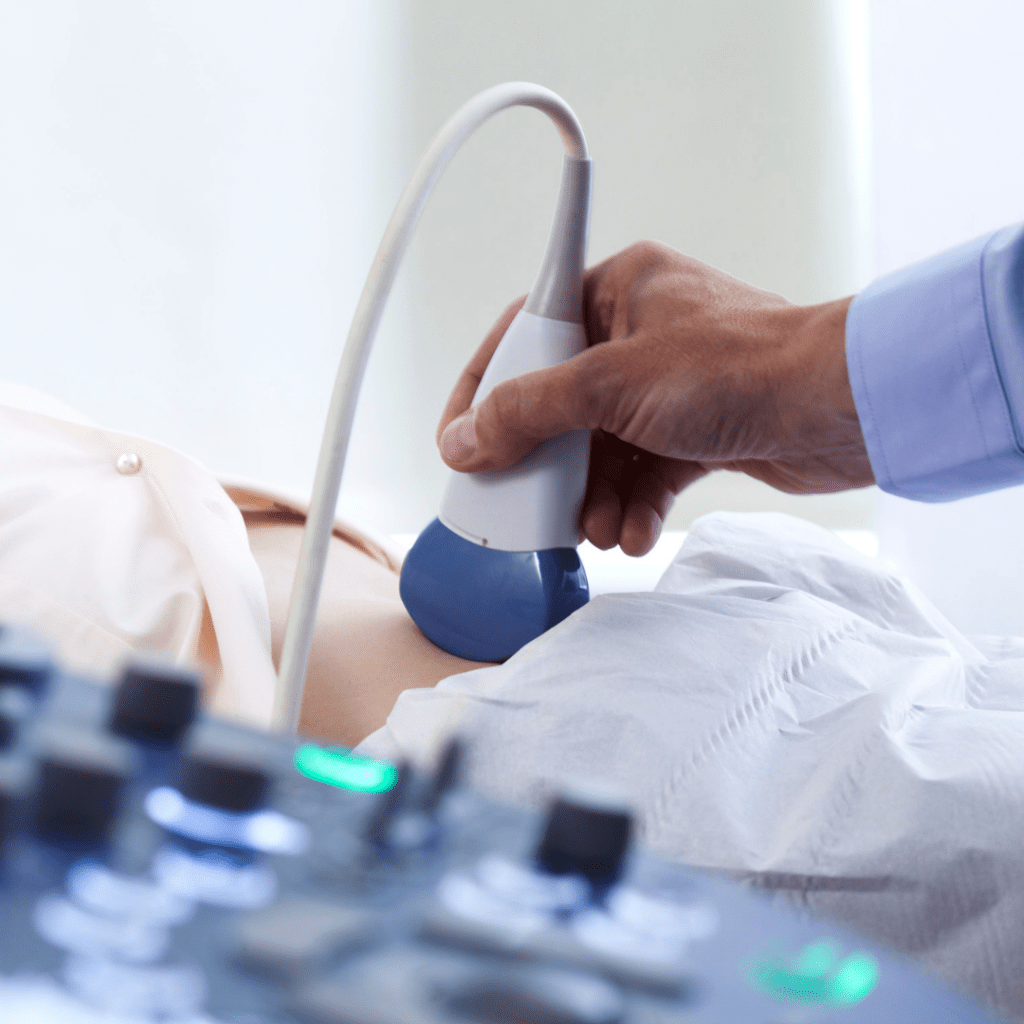 twins ultrasound wand over a woman's belly