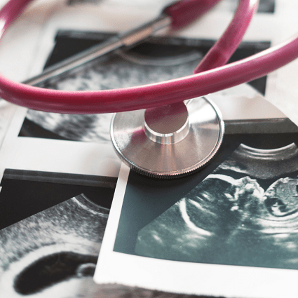 twins ultrasound pictures with a stethoscope placed on top
