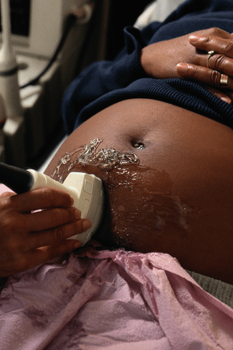 twins ultrasound ultrasound wand on a woman exposed belly