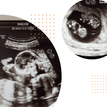 Twins Ultrasound: 10 Tips to Get The Most Out Of Your Visit