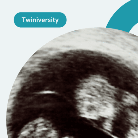 Twins Ultrasound: 10 Tips to Get The Most Out Of Your Visit