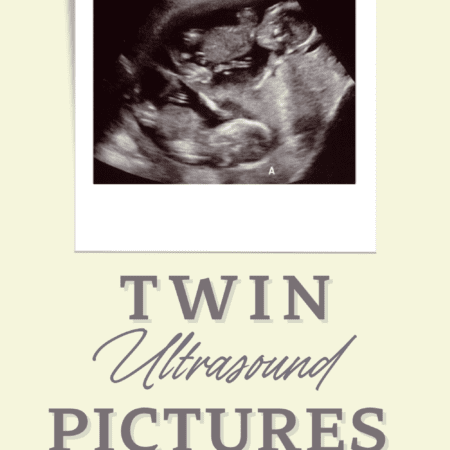 Twins Ultrasound: 10 Tips to Get The Most Out Of Your Visit