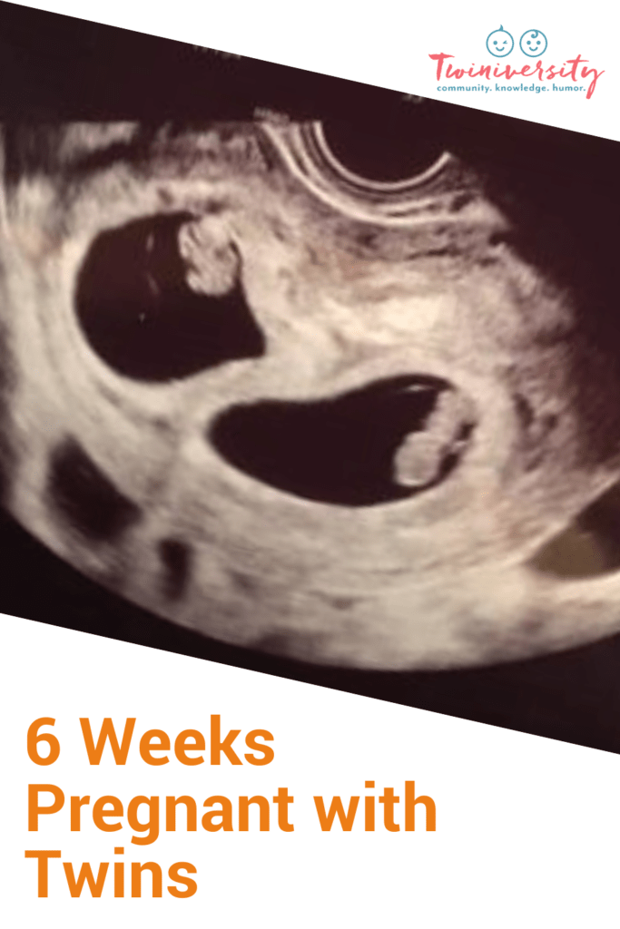 6 Weeks Pregnant with Twins