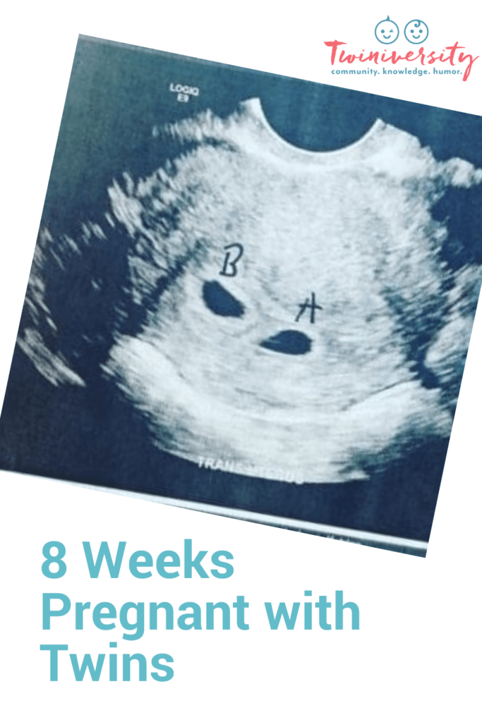 8 Weeks Pregnant With Twins
