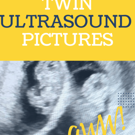 8 week twin ultrasound pictures