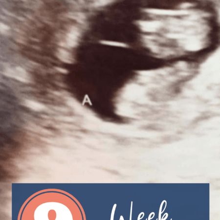 9 week ultrasound