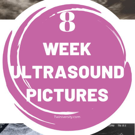 8 week ultrasound pictures