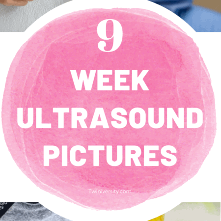 9 week ultrasound pictures