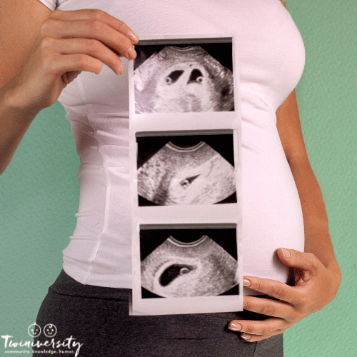 a pregnant woman holds her ultrasound photos of her di-di twins