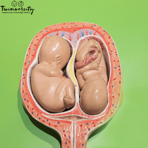 an image of a di-di twins in the womb