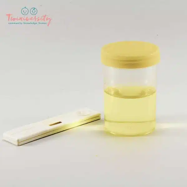 Can hCG Levels Be Found In Urine