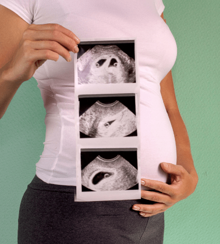 a pregnant woman holding her belly and a sheet of twin ultrasound photos up