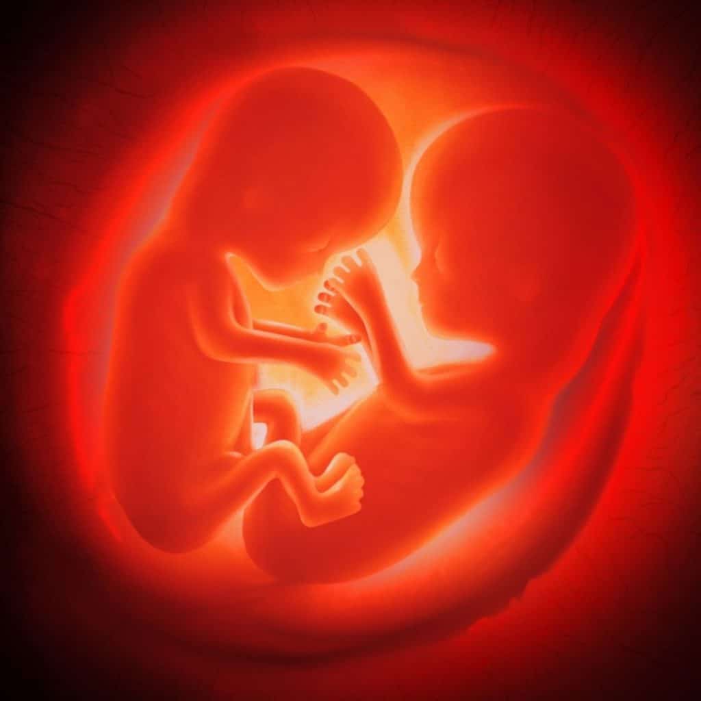 Two fetuses I the womb, bonding with each other by t