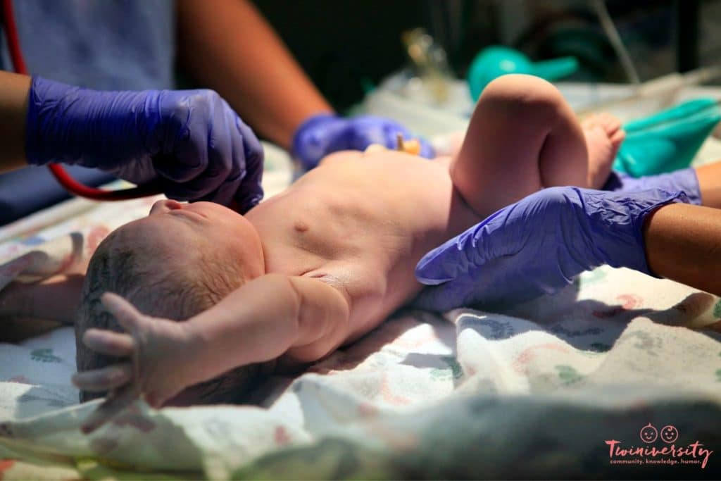 C-section breakdown: newborn baby on a warmer being assessed by multiple nurses and doctors