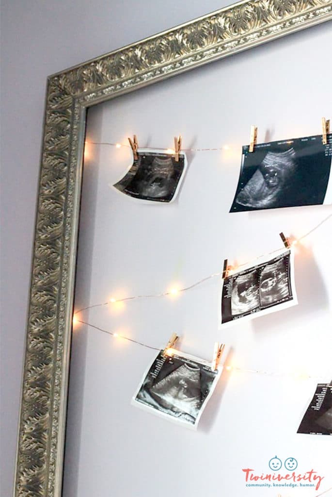 An empty picture frame hung on the wall with ultrasound images hung on fairy lights.