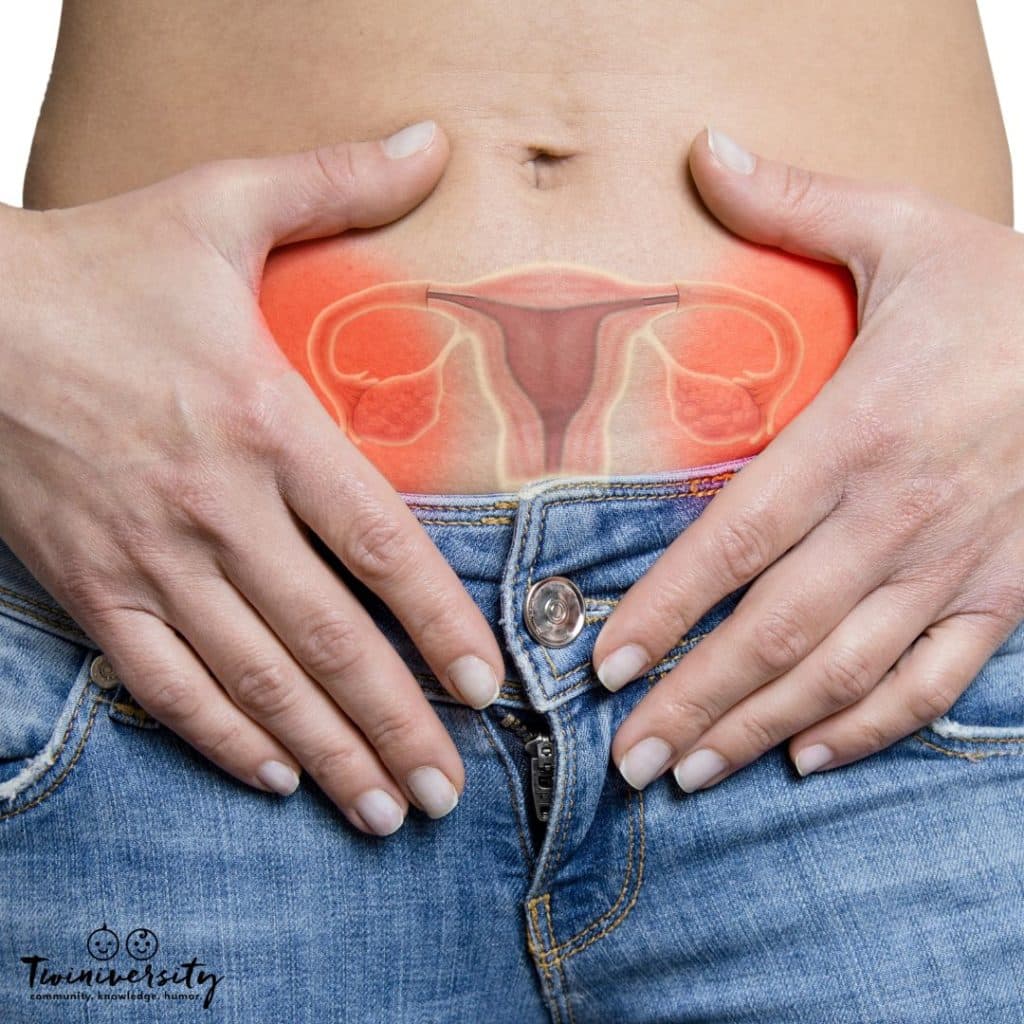 Close-up picture of a woman's lower abdomen, to illustrate that she has a shortened cervix 