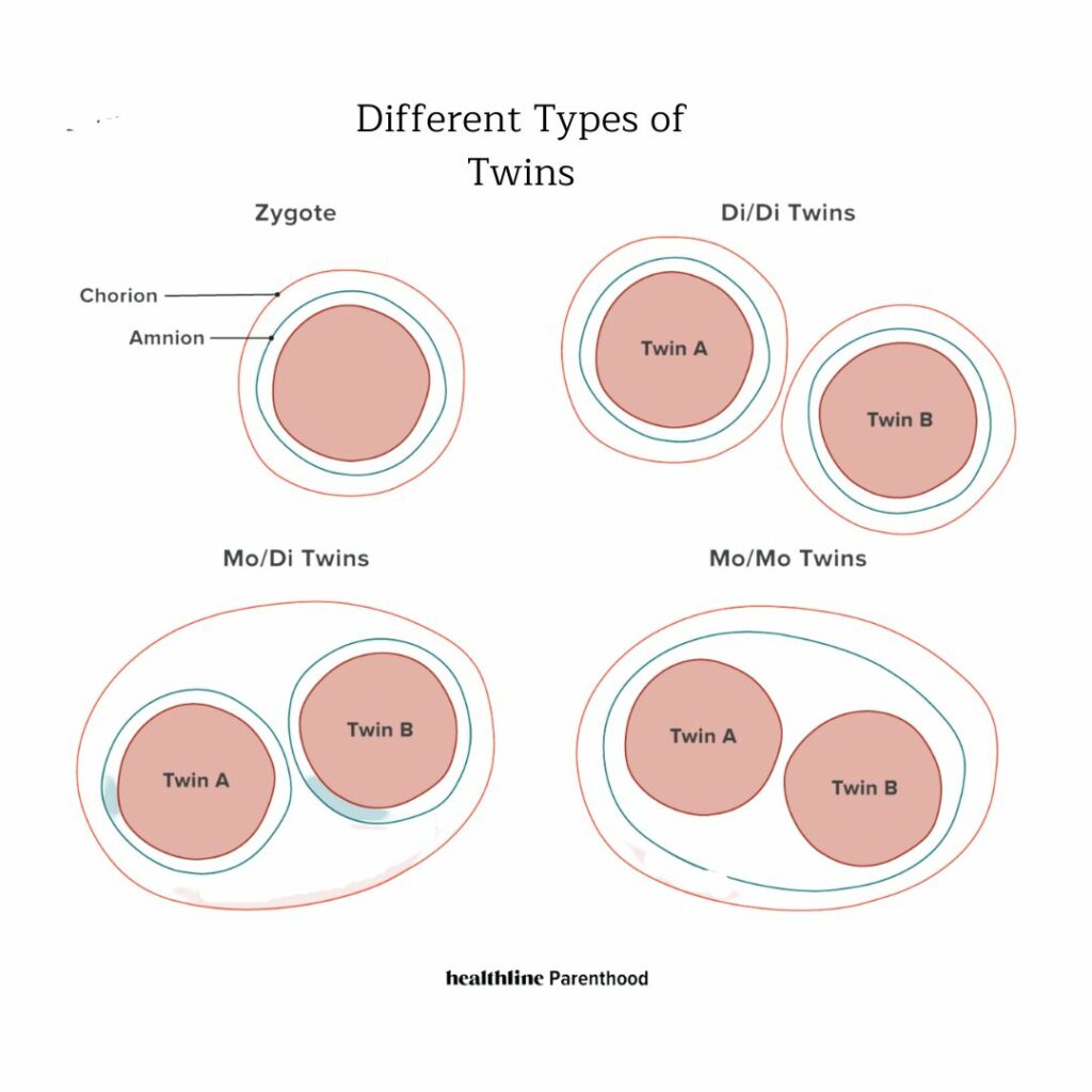 diagram of the types of twins in utero including what mono mono twins are