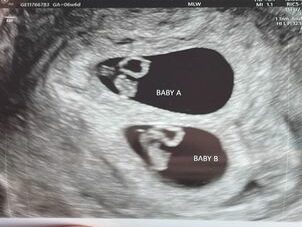 6 week sonogram