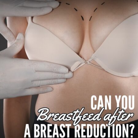 Breastfeeding after a Breast Reduction