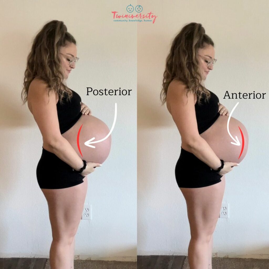 Anterior and Posterior placenta positions