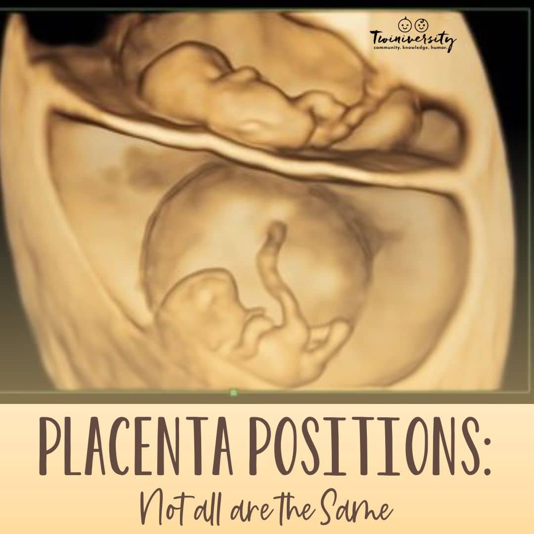 Placenta Position: Not all are the Same