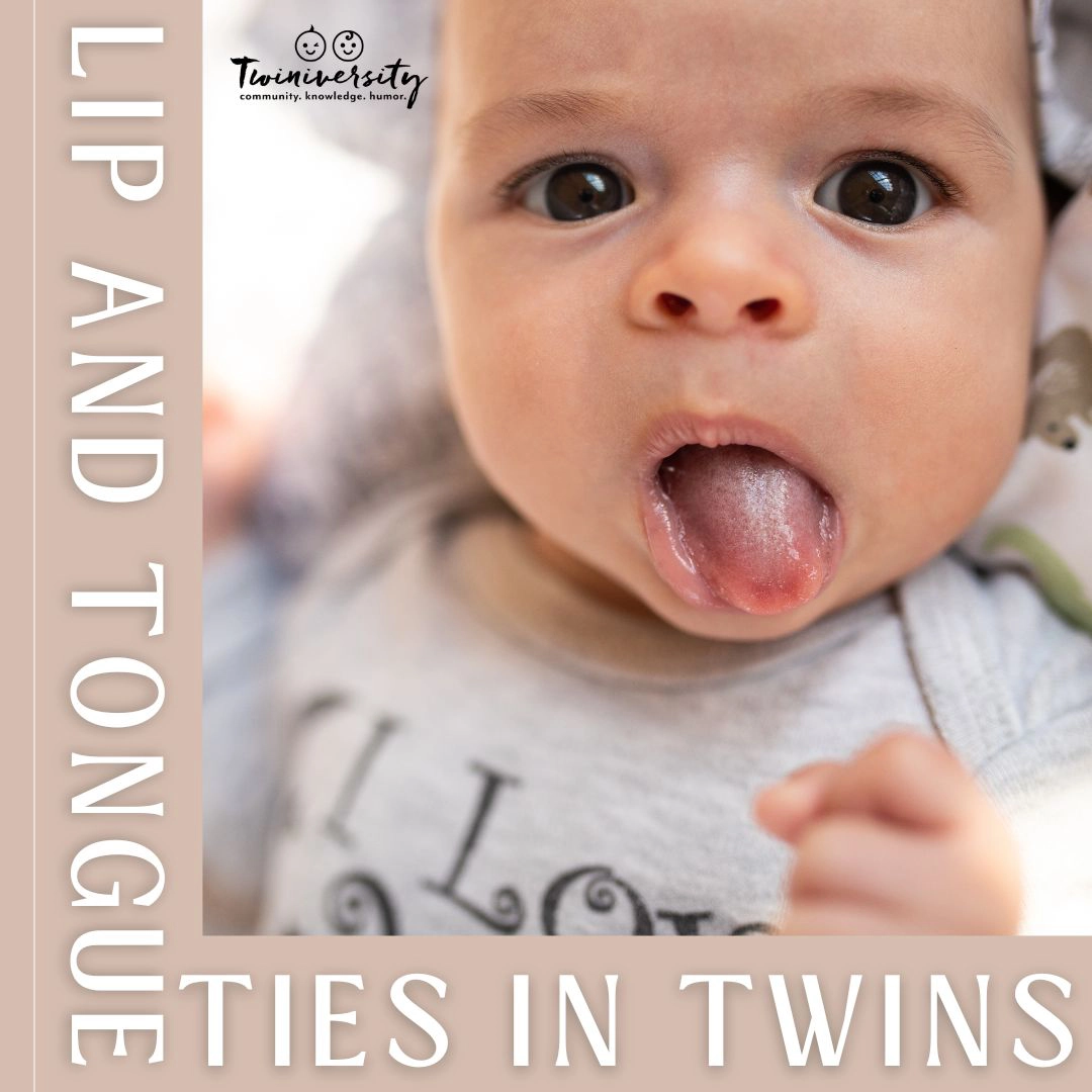 Tongue and Lip Ties in Twins