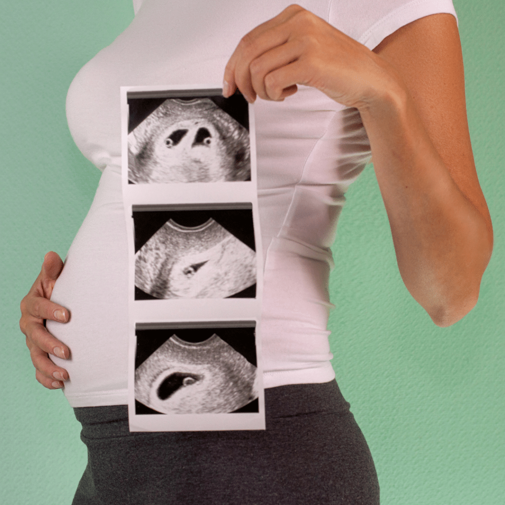 twin pregnancy