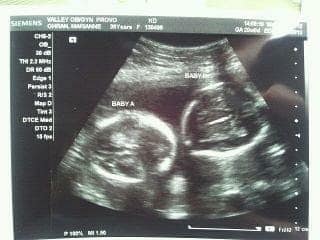 20 weeks pregnant with twins (1)