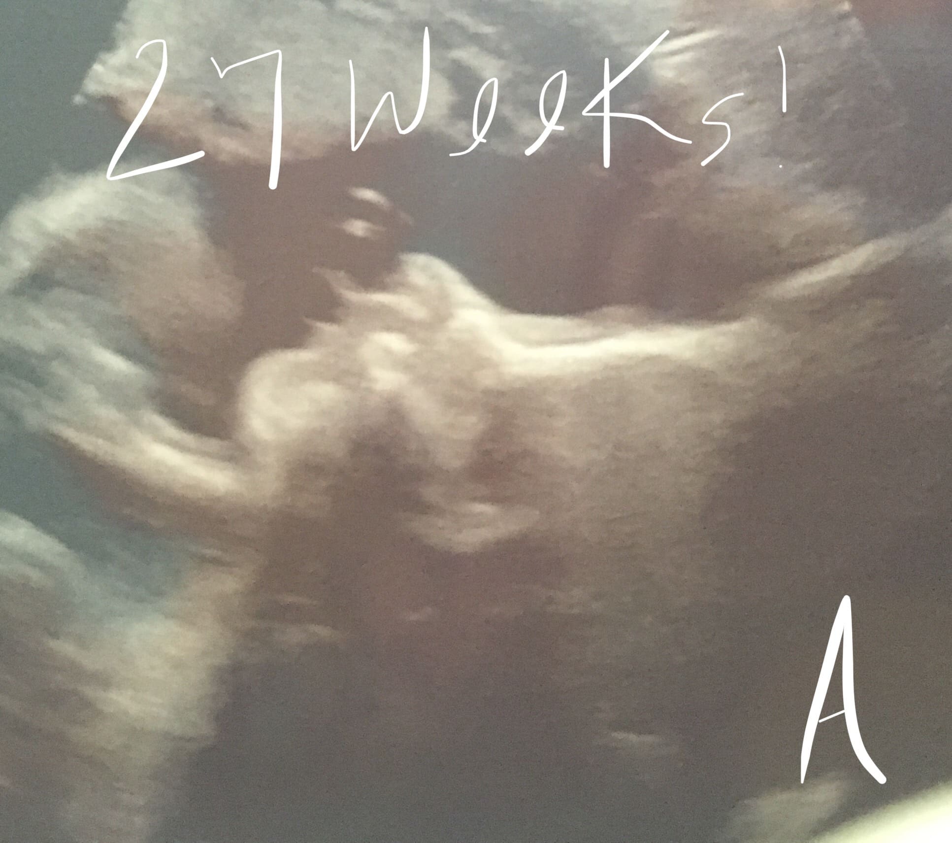 27 weeks pregnant with twins