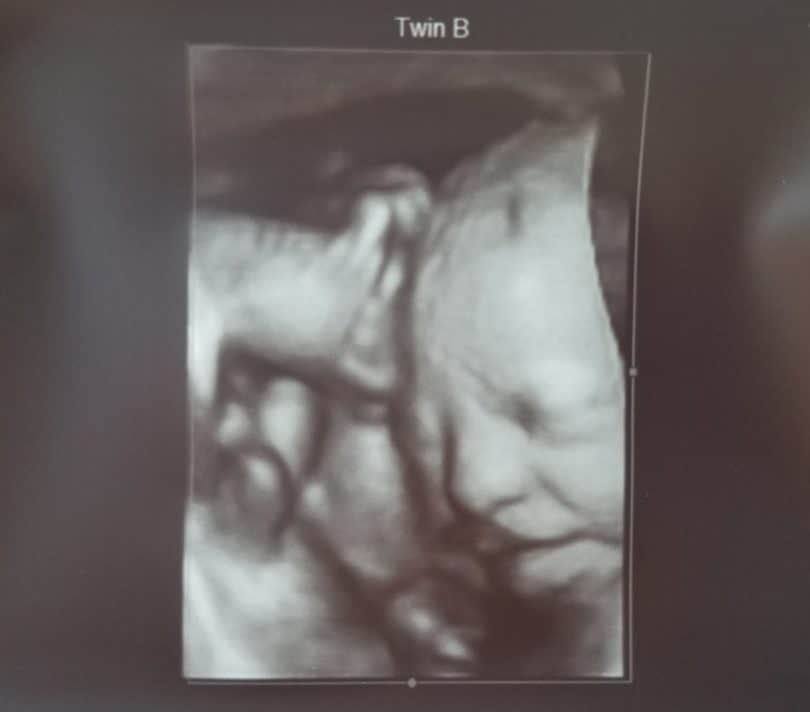 30 weeks pregnant 3d ultrasound Qaslava