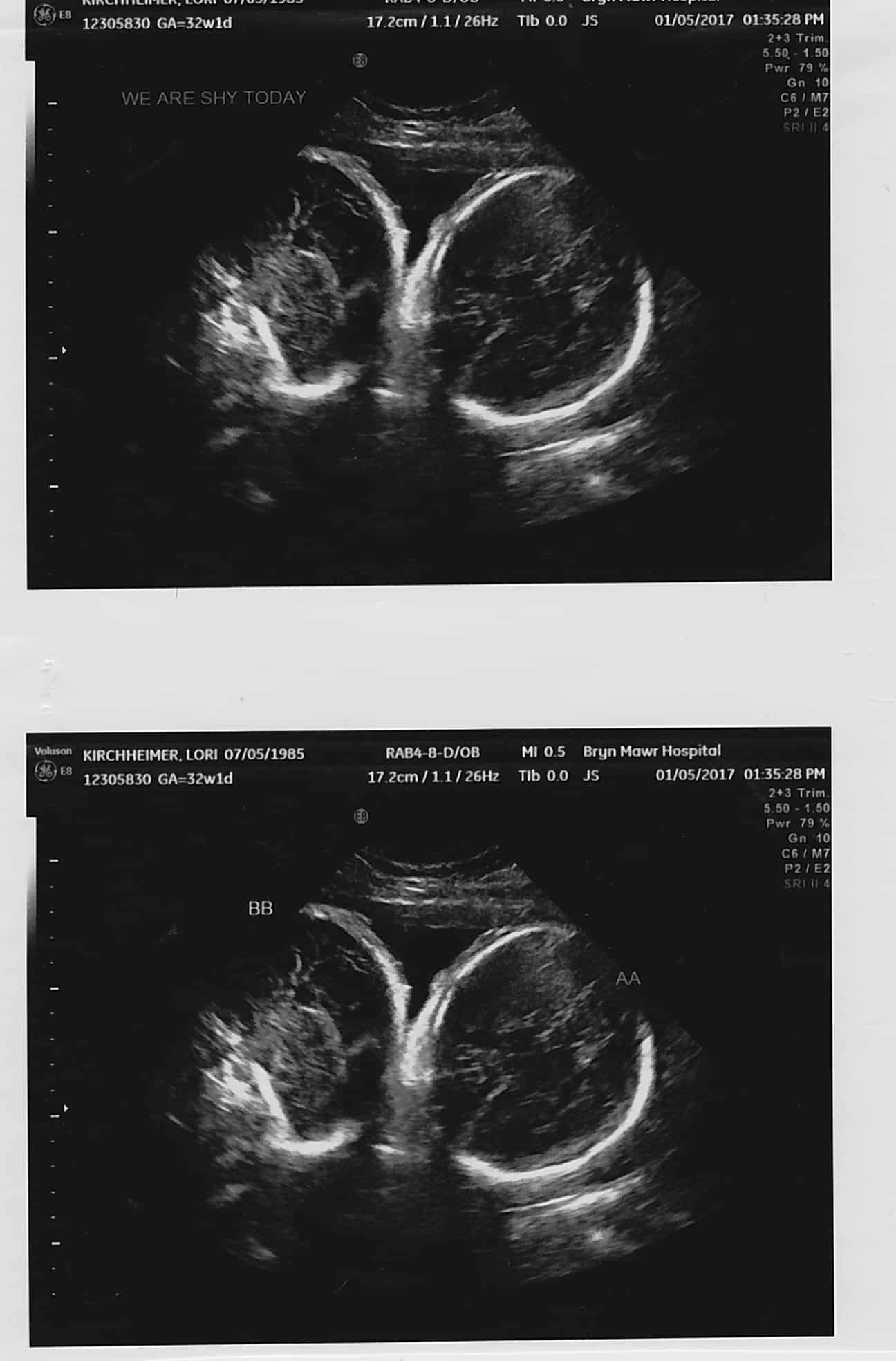 32 weeks pregnant with twins