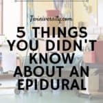 5 Things You Didn't Know About an Epidural