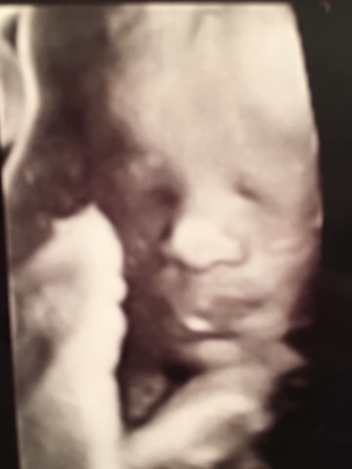 35 weken zwanger van een tweeling