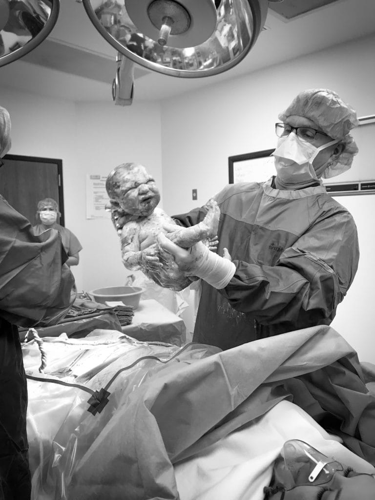 emergency c-section