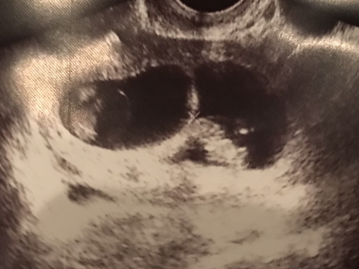 twins ultrasound medical team