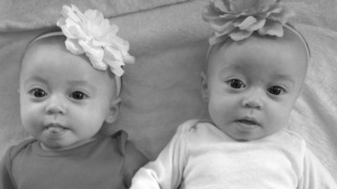 The Ultimate Twin Pregnancy Guide