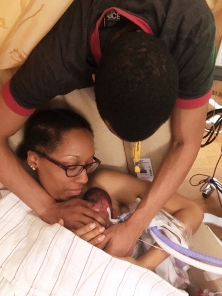 mom doing skin to skin with preemie Pregnancy Ended at 24 Weeks